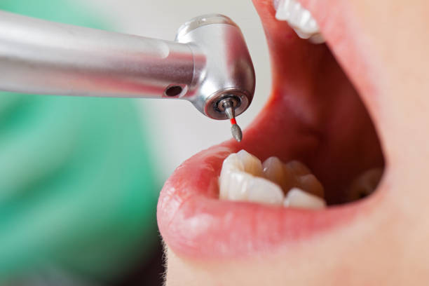Best Broken Tooth Emergency  in Burney, CA
